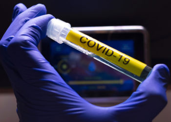 كوفيد 19 .. تسجيل 2793 إصابة مؤكدة جديدة بالمغرب خلال 24 ساعة الماضية