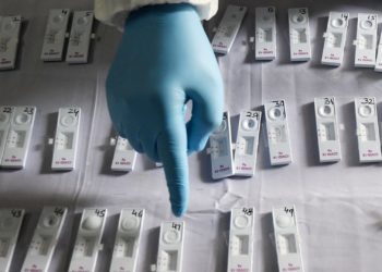 وزارة الصحة .. تسجيل   2566 إصابة جديدة بفيروس كورونا خلال 24 ساعة‎