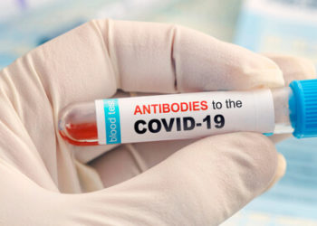 وزارة الصحة .. تسجيل 1279 إصابة و44 وفاة جديدة بـ”كورونا” في 24 ساعة