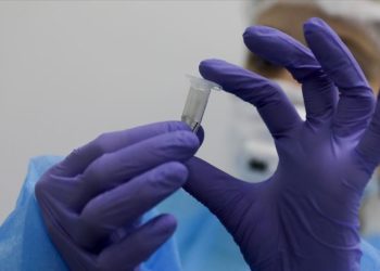 وزارة الصحة .. تسجيل 1416 إصابة و24 وفاة جديدة بـ”كورونا” في 24 ساعة