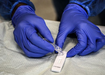 “جيغالاب” تطلق وحدة صناعية لإنتاج اختبارات كوفيد-19 “صنع في المغرب”