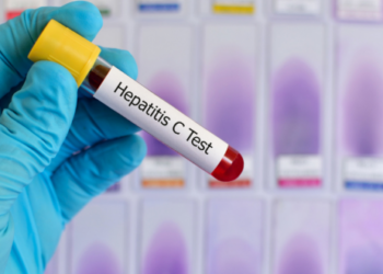 “Moldiag” تعلن عن إنتاج وتسويق أول اختبار تشخيصي جزيئي مغربي 100% لالتهاب الكبد الوبائي C