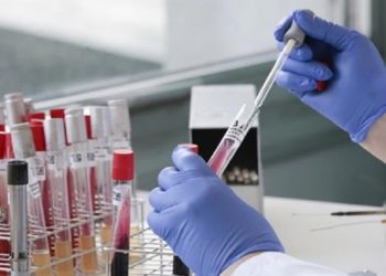 رئيس الجمعية العامة للأمم المتحدة يشيد بجهود المغرب في تصنيع اللقاحات