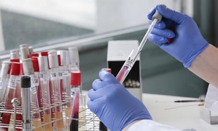 رئيس الجمعية العامة للأمم المتحدة يشيد بجهود المغرب في تصنيع اللقاحات